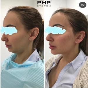 Фотография PHP System 4